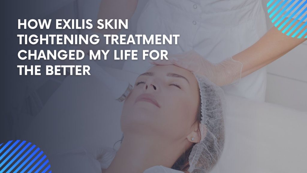 How Exilis Skin Tightening Treatment Changed My Life for the Better