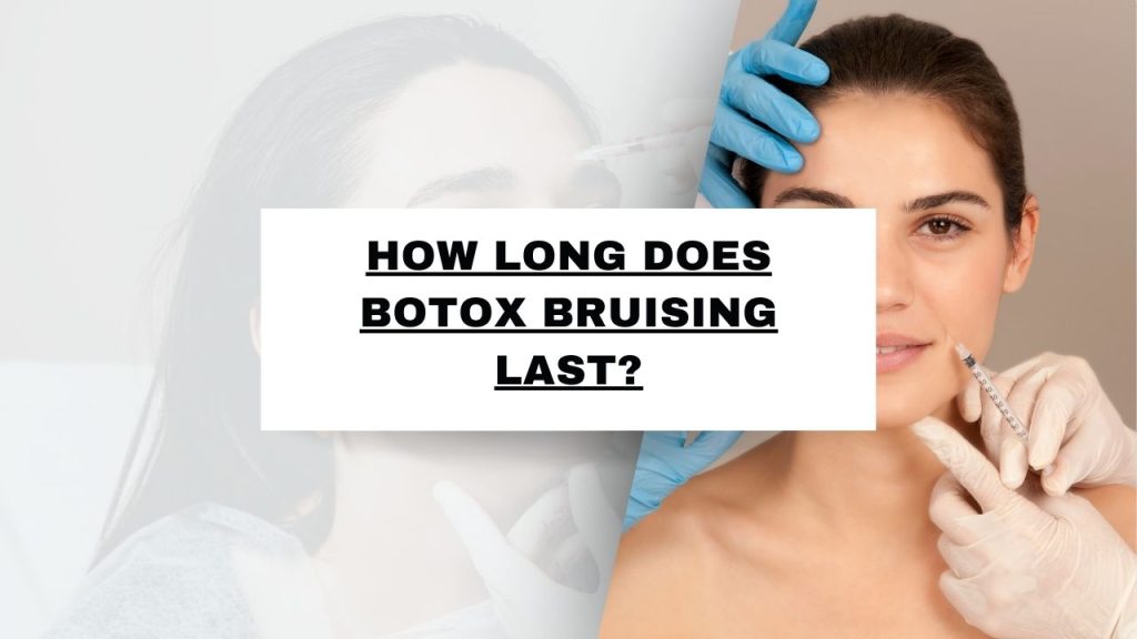 How Long Does Botox Bruising Last?